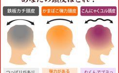 あなたの頭皮はどれ？頭皮診断