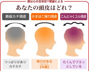 あなたの頭皮はどれ？頭皮診断